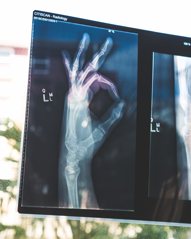 X-RAY - Daily Care Medical Laboratory